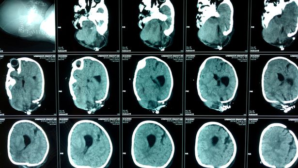 Cranio di Yamanoor (2)