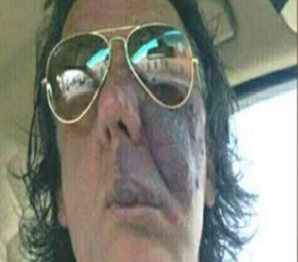 Abusi sui pazienti, caso Spanò