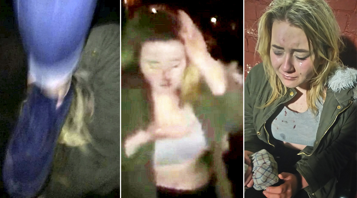 Il momento dell'attacco