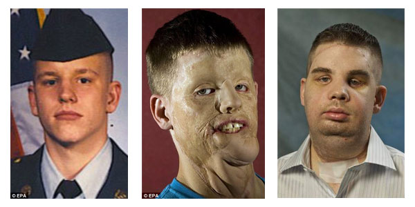 La trasformazione di Mitch