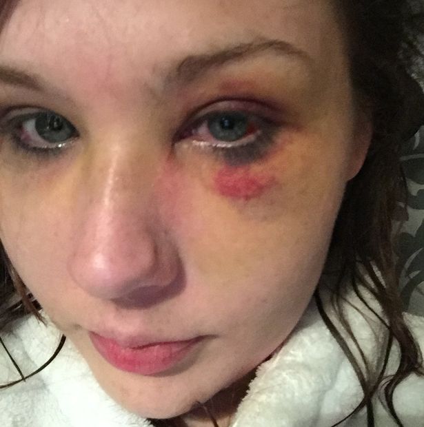 Violenze domestiche (2)