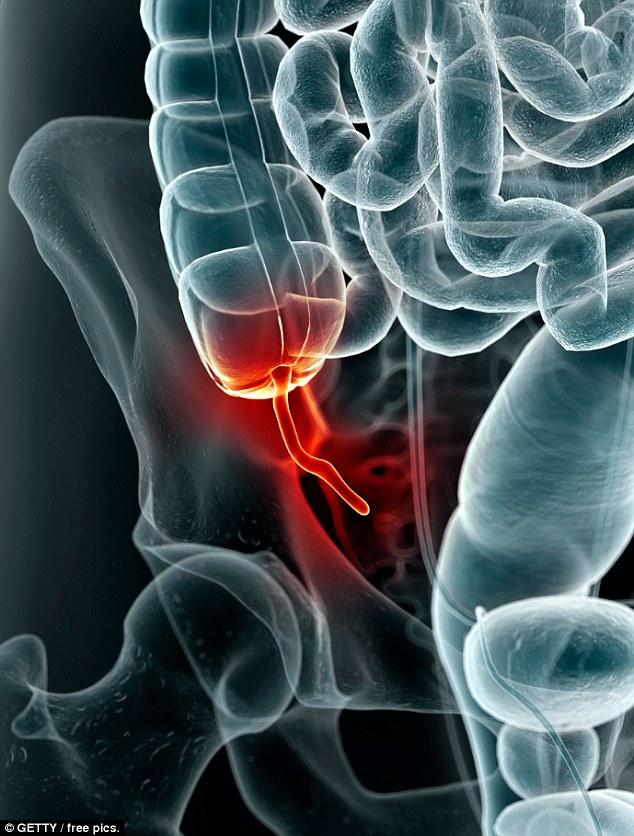 Appendice infiammata