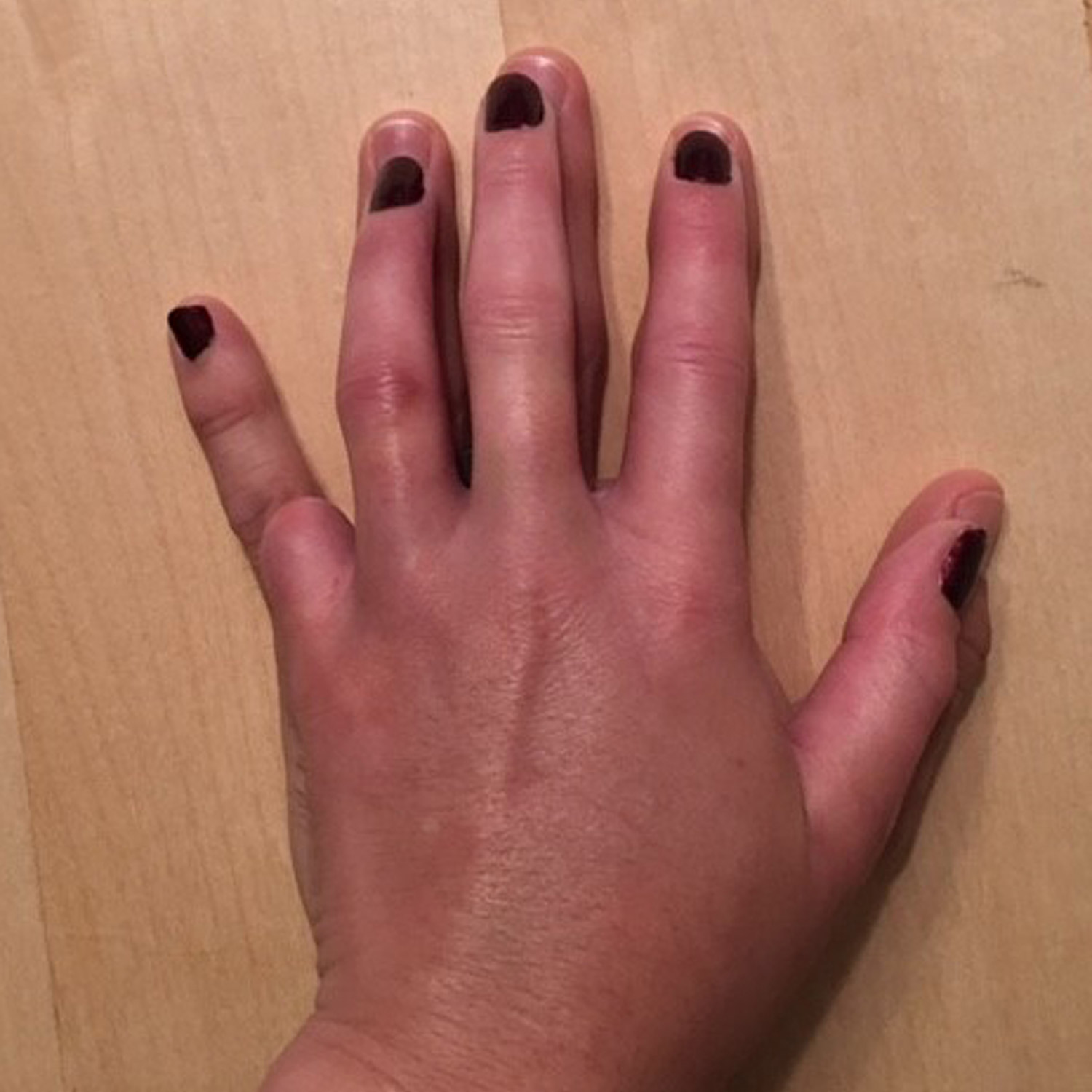 Le mani di Libby e di Matt