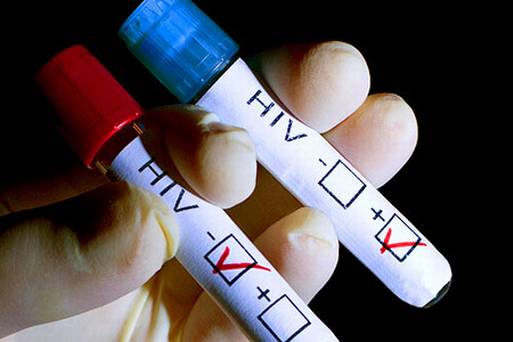 Test HIV