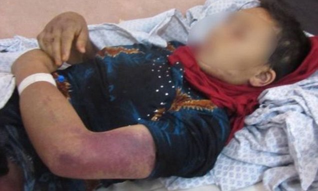 Ricovero in ospedale