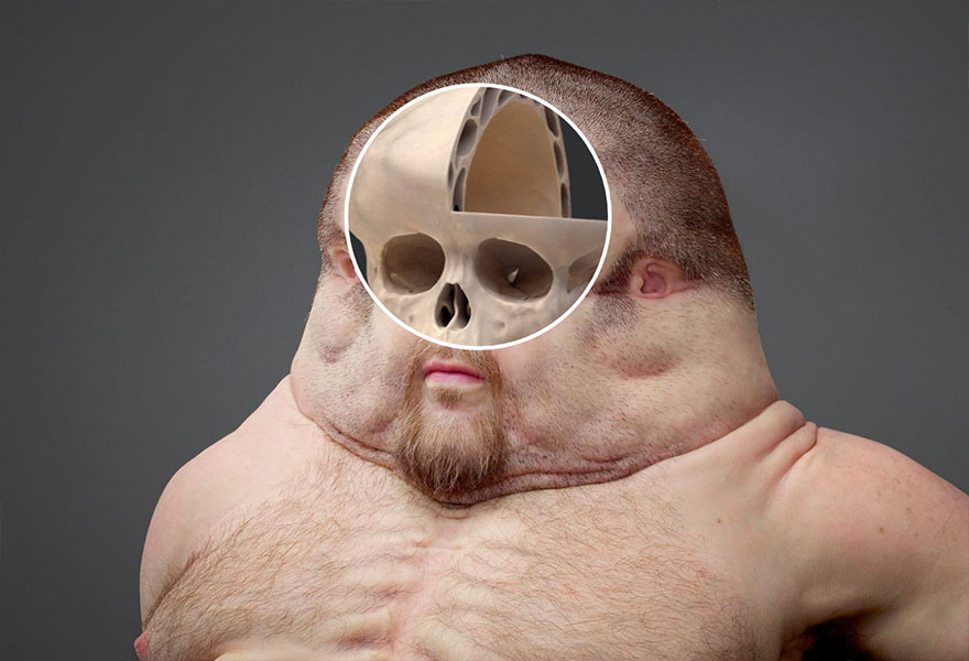 Il teschio di Graham (2)