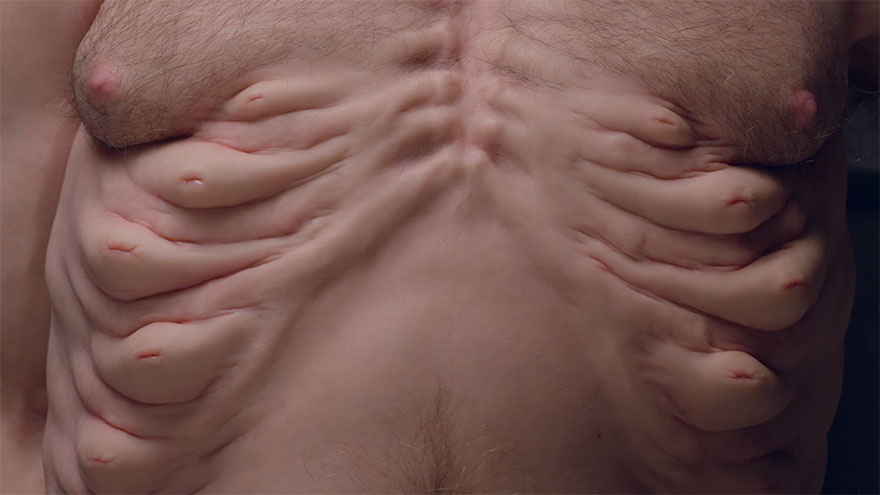 I capezzoli di Graham