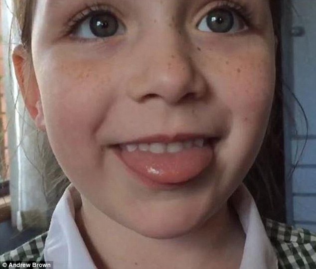 Hayley prima della chemioterapia