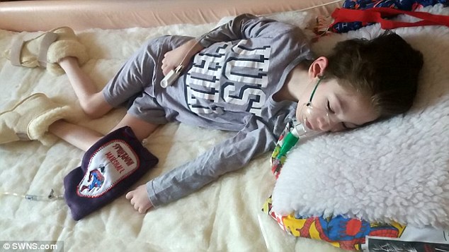 Malattia di Marshall