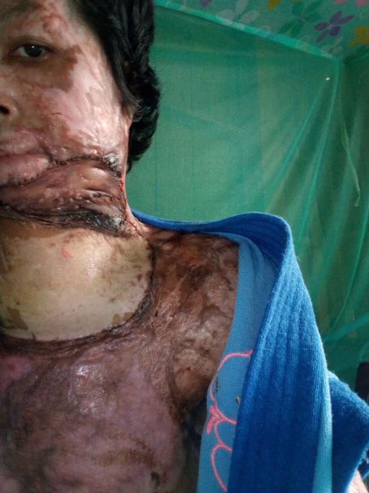 Nadnapha Nuankhu (1)