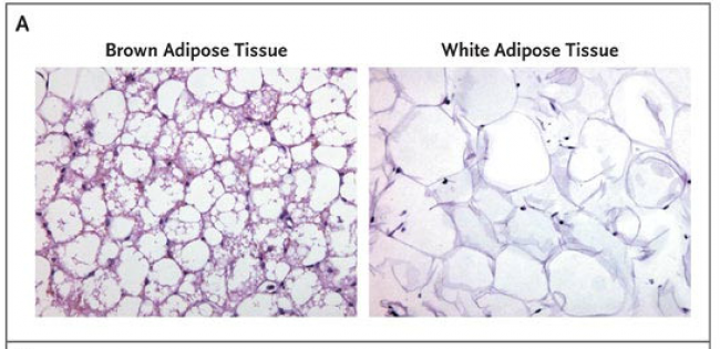 Grasso bruno e grasso bianco