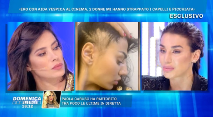 aggressione Patrizia Bonetti e Aida Yespica