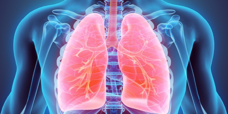 Trapianto di polmone da donatori vivi